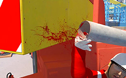 Material Handling Accidents