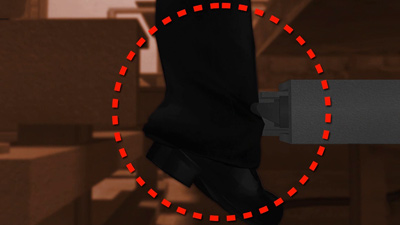 Kiln Car Crushed leg injury